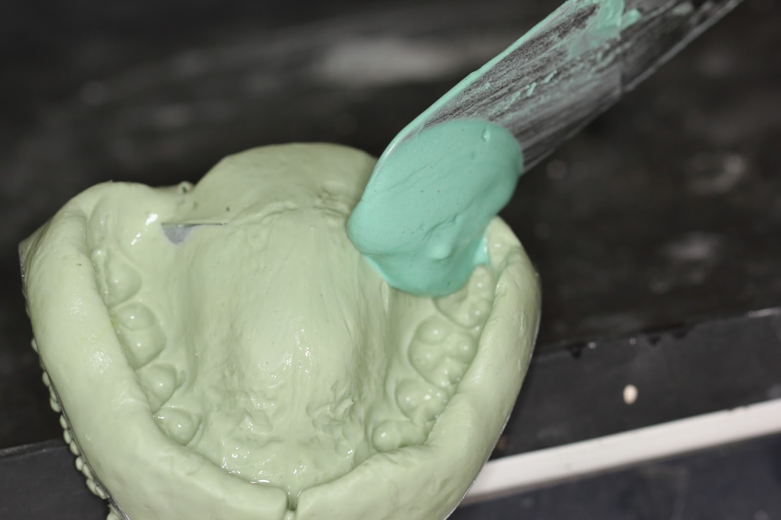 Understanding Prosthodontics Tagore Dental College & HospitalBy