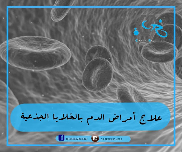 علاج أمراض الدم بالخلايا الجذعية