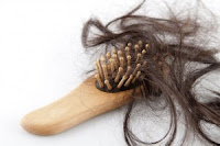 Rambut Rontok Setelah Melahirkan Rambut Rontok Setelah Melahirkan