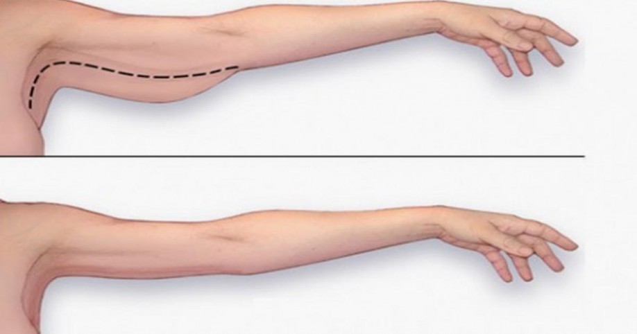 The Best Exercises To Lose Arm Fat At Home