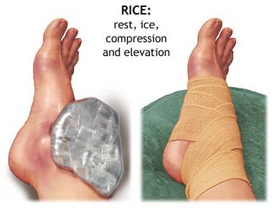 Do and Don't Bila Kaki Terseliuh! Rawatan Bila Kaki Terseliuh!