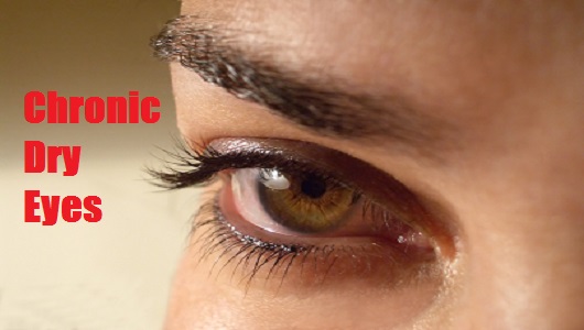 Relief for Sore and Itchy Eyes