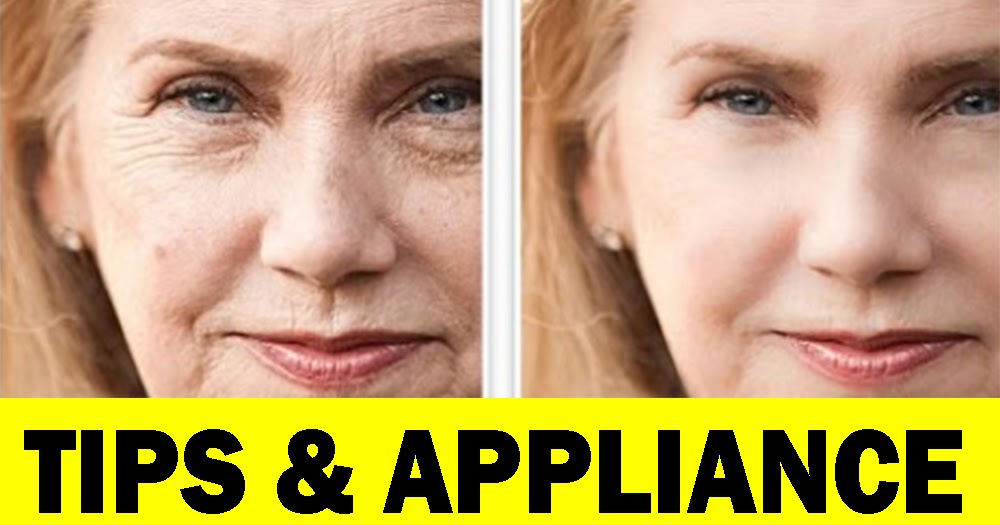 Look a Decade Younger With Vaseline Wrinkle Removal Tips & Appliance