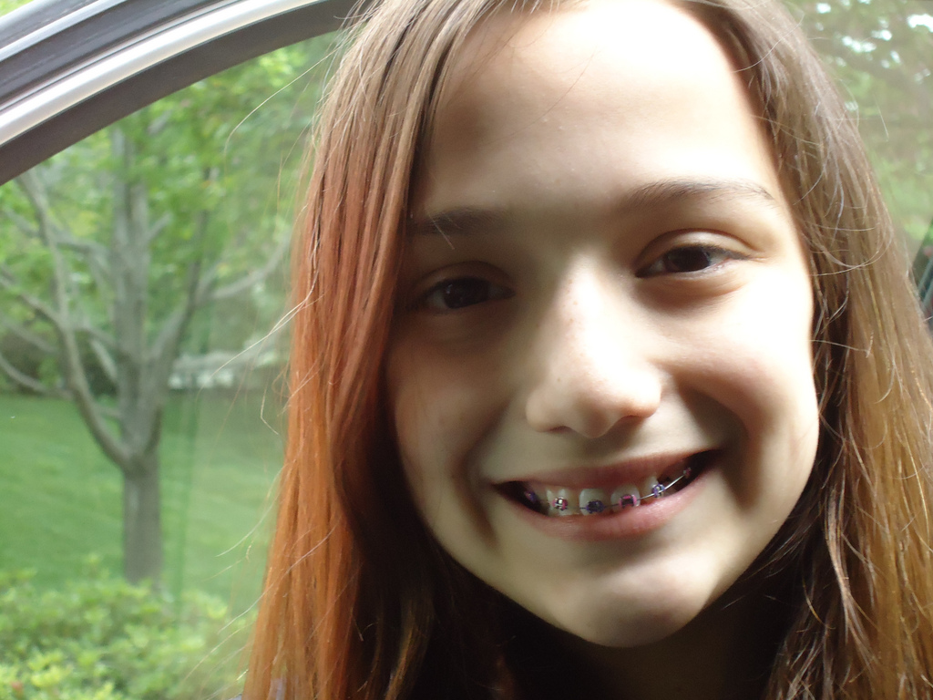 So How Was Your Day? Just call her Tinsel Teeth