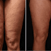 What She Spreads On Her Skin, Everyone Has at Home – But Nobody Uses It!