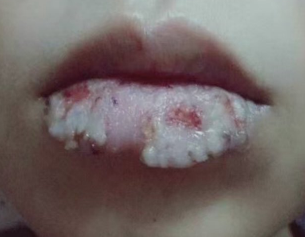 post-feature-image