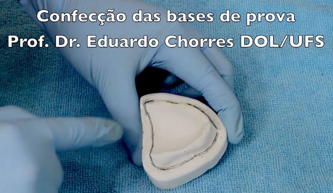 PRÓTESE TOTAL: Confecção de base de prova - Prof. Dr. Eduardo Chorres