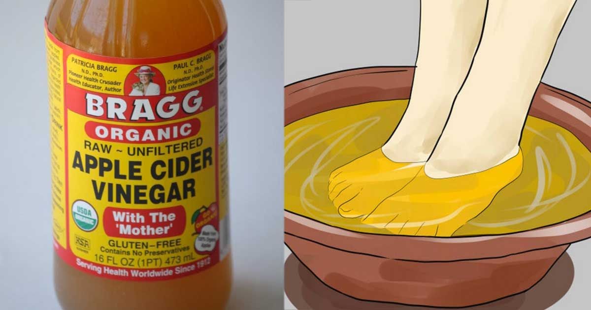 Live Healthy Live Longer Vinegar Foot Soaks Benefits And Tips The