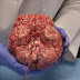 This Video Of A Freshly Removed Human Brain Has Fascinated The World