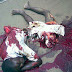 Tragic Accident: Trailer Crushes Man Into Two - Graphic Photo