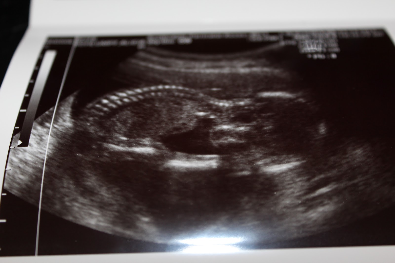 And Baby Makes Three: 17 Week Ultrasound