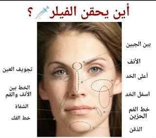 ما هو الفيلر والبوتكس - فوائد حقن الفيلر والبوتكس ما هو الفيلر والبوتكس - فوائد حقن الفيلر والبوتكس