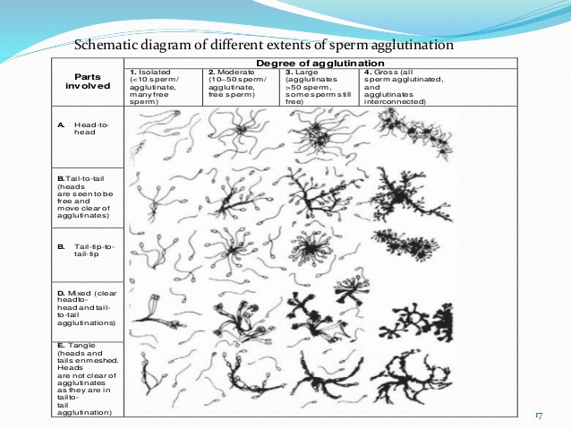 Tingkat Penggumpalan Sperma : Aglutinasi Positif Tingkat Penggumpalan Sperma : Aglutinasi Positif