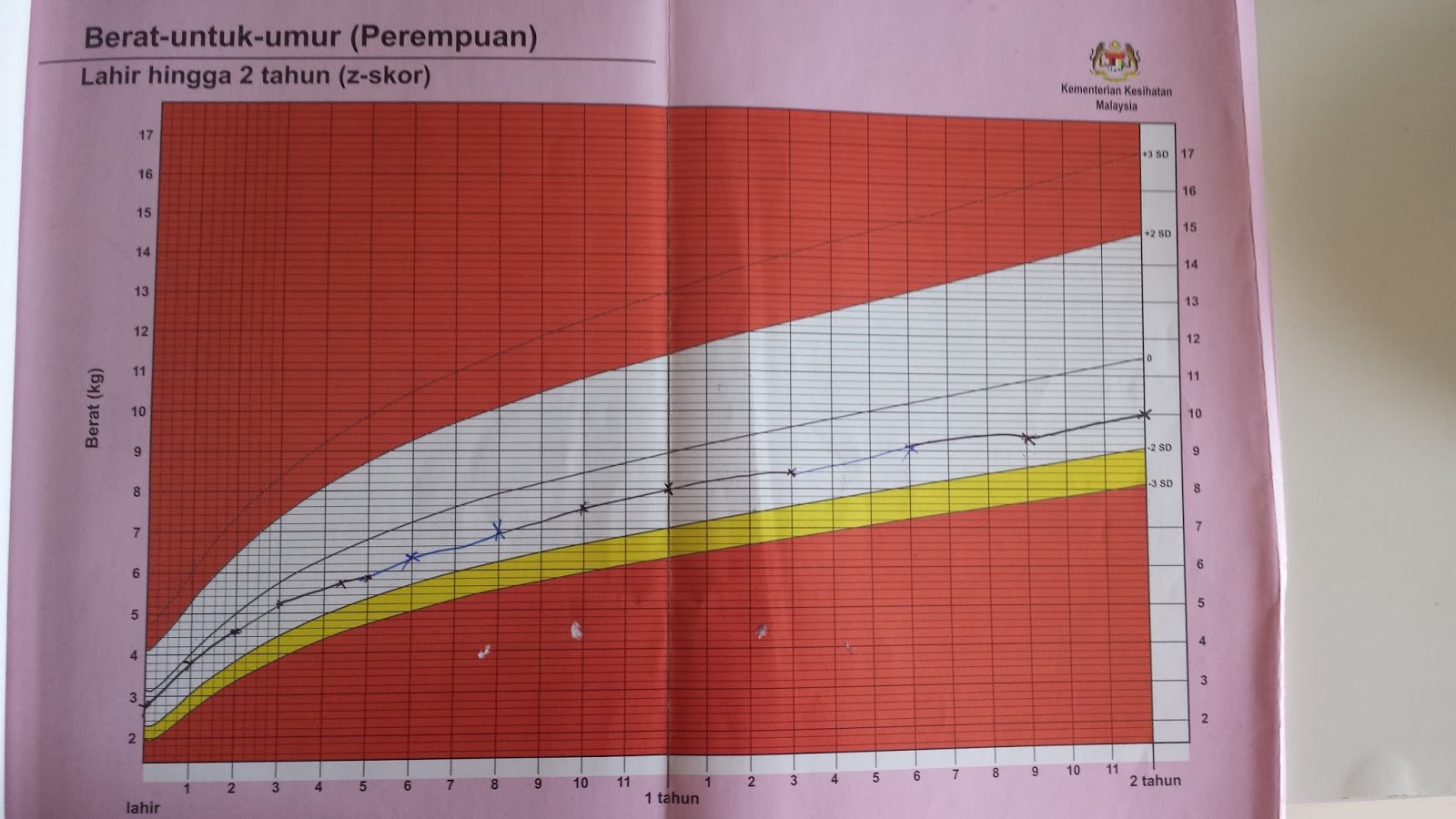 6 Sebab Anak Kurang Berat Badan dan Tips Mengatasinya  SARALICIOUS VITAMIN