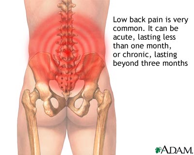 Lower Back Pain: Very Sore Lower Back Pain