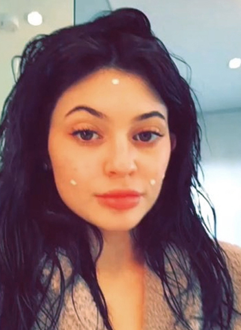 13 celebrities with acne 2018 Celebrity acne scars Celebrities with