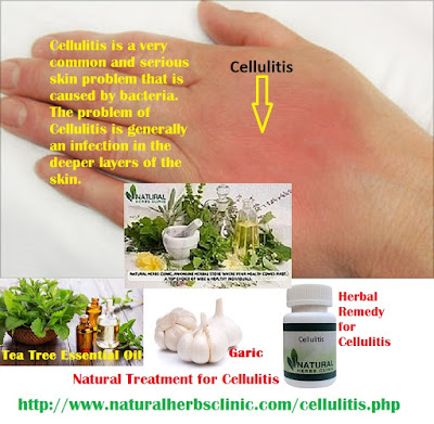 dunlop 300g tennis warehouse