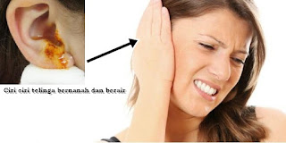 obat herbal untuk telinga bernanah dan berair yang aman obat herbal untuk telinga bernanah dan berair yang aman