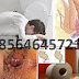 Gambar Obat Ambejoss dan Bentuk Wasir Wanita thumbnail
