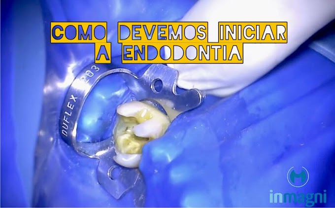 ENDODONTIA: Tratamento de canal - Como devemos iniciar a endodontia