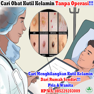 Obat Kutil Kelamin Obat Kutil Kelamin