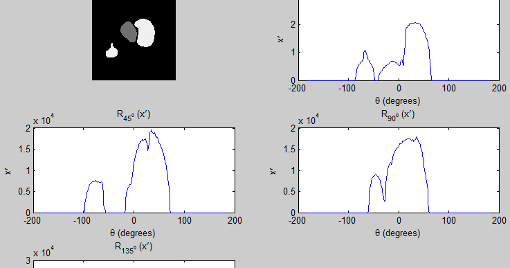Biomedical Signal and Image Processing projects using Matlab and ...