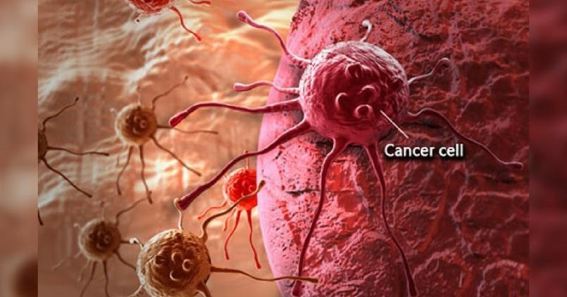 Understanding how cancer begins - PNG Health News and Tips