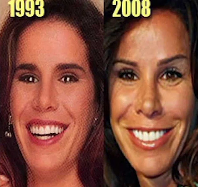 Melissa Rivers Plastic Surgery Before and After Photos Melissa Rivers Plastic Surgery Before and After Photos