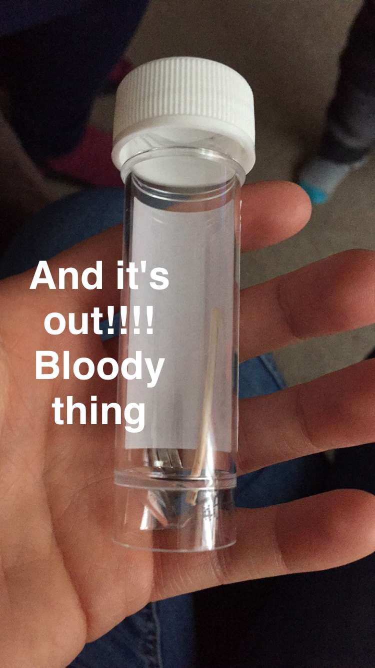 Tantrums, Tears, & No Tiaras My nexplanon implant saga