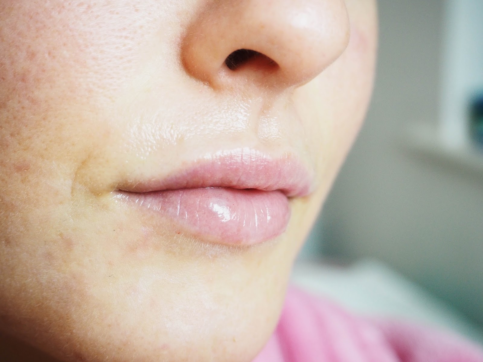 I GOT MY LIPS DONE!! GIRL TALK WITH LAURA