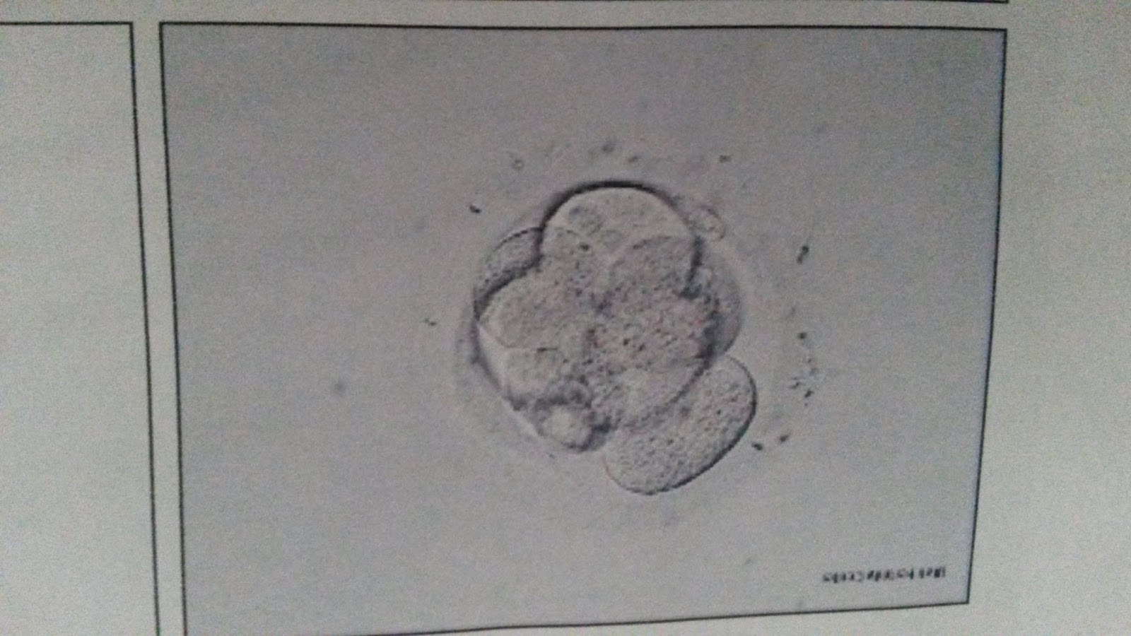 darcy ivf embryo