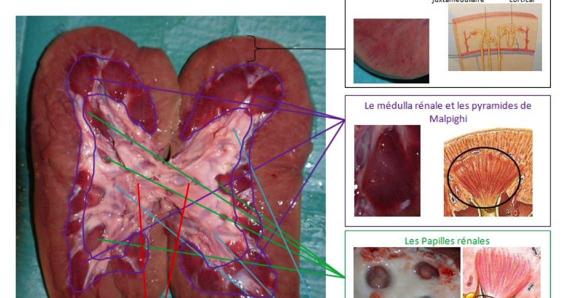 Photo De La Rate Dans Le Corps Humain TPE 2012 - 2013 : Dans quelles mesures la dialyse peut-elle remplacer