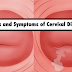 Women Needs To Observe 7 Warning Signs Of Cervix Disease