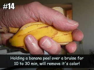 Banana Peels to Heal Bruises Banana Peels to Heal Bruises