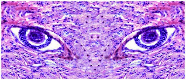 medical laboratory and biomedical science histology eyes