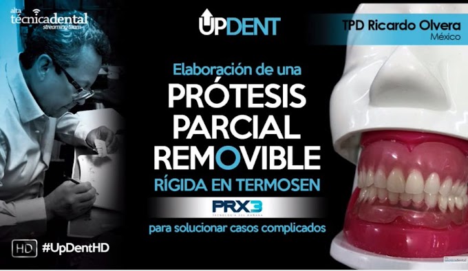 WEBINAR: Elaboración de una Prótesis Parcial Removible para solucionar casos complicados - TPD Ricardo Olvera