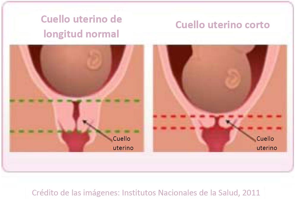 cocinitas de fibrofacil