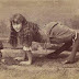 The 10 Real People With Shocking And Extreme Deformities