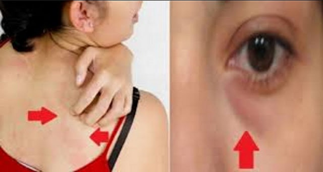 8 ALARMANTES SIGNOS DE QUE ESTÁ COMIENDO DEMASIADO AZÚCAR! 8 ALARMANTES SIGNOS DE QUE ESTÁ COMIENDO DEMASIADO AZÚCAR!
