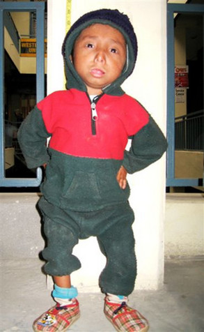 A Poor Mans Resume: 17 Year Old Boy is Only 22 inches Tall