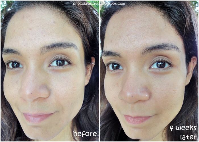 anti aging gél arc labor anti aging szemkrém felülvizsgálat