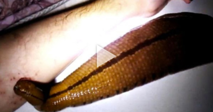 Owner gives parasitic pet its daily dose of blood straight from his arm