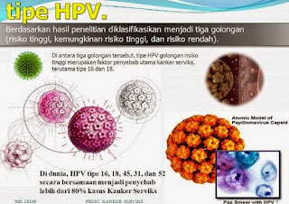 Gambar Dan Ciri-Ciri Kutil Kelamin Serta Cara Menyembuhkannya Gambar Dan Ciri-Ciri Kutil Kelamin Serta Cara Menyembuhkannya