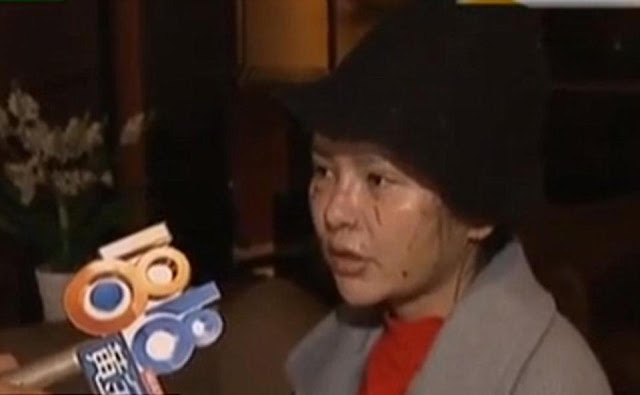 Dicakar Teman Sendiri Usai Oplas, Simak Alasannya yang Ternyata Sepele!