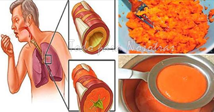 Las flemas de natural los remedio pulmones para sacar