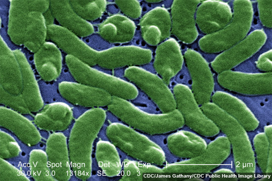 Vibrio vulnificus - CDC - James Gathany - CDC Public Health Image Library