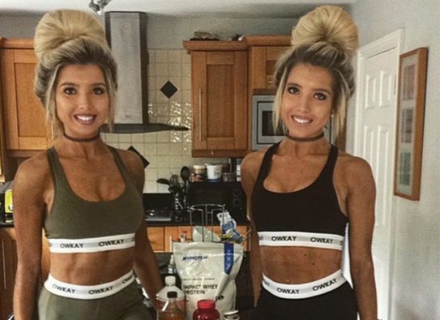 Gemelas consumieron cuatro mil calorías diarias para subir de peso Aoife у Ciara Tabb