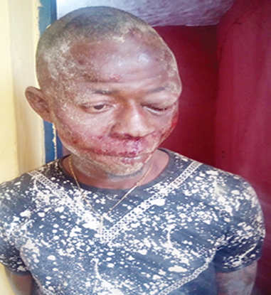 robber beaten benin edo state
