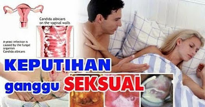 Image Yang perlu diketahui wanita!keputihan yang tidak nornal