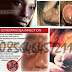 Obat Tradisional Vagina dan Penis Keluar Nanah thumbnail
